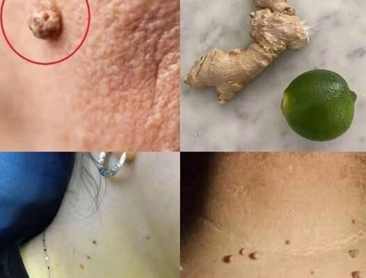 Чистотіл великий: які його переваги та як його використовувати? Чистотіл великий: які його переваги та як його використовувати?