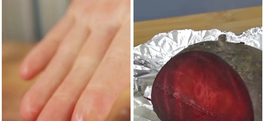 Ось що дійсно допомагає відмити руки від буряка: не сода і не лимонна кислота – це лагідніше і не сушить Ось що дійсно допомагає відмити руки від буряка: не сода і не лимонна кислота – це лагідніше і не сушить