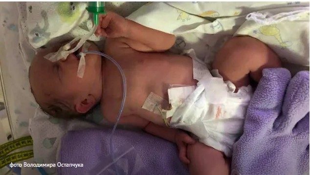 Померла на очах у матері, проживши чотири дні: у Львові розслідують смерть новонародженої дівчинки