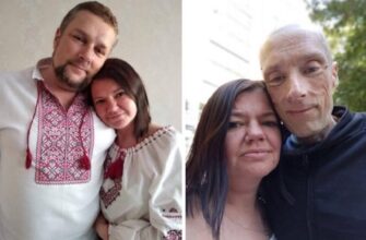 Військовий у російському полоні змінився до невпізнаваності: шокувальні фото