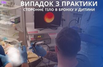 Дитину 1,7 року нагодували соняшниковим насінням: Результат – у Рівному провели операцію (ФОТО)