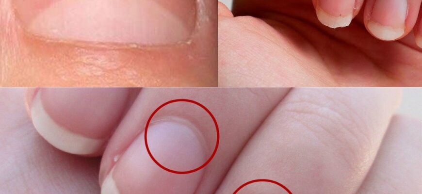 Якщо у вас на нігтях немає форми півмісяця, негайно подбайте про це.