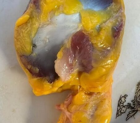 Чому корисно їсти курячі шлунки?