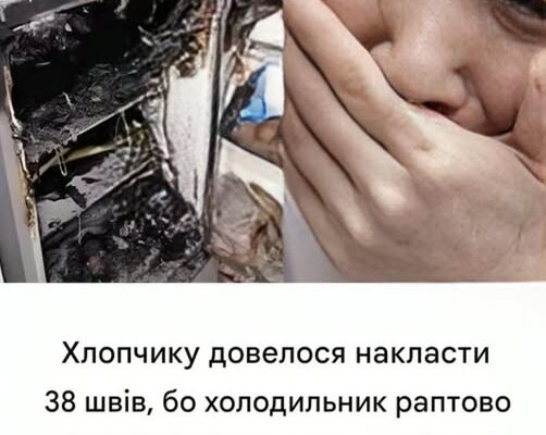 Хлопчику довелося накласти 38 швів, бо холодильник раптово закрився. ᴇxᴘʟᴏᴅᴇᴅ: yваrа: Не кладіть ці речі в морозилку.