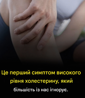Це перший симптом високого холестерину, який більшість із нас ігнорує.