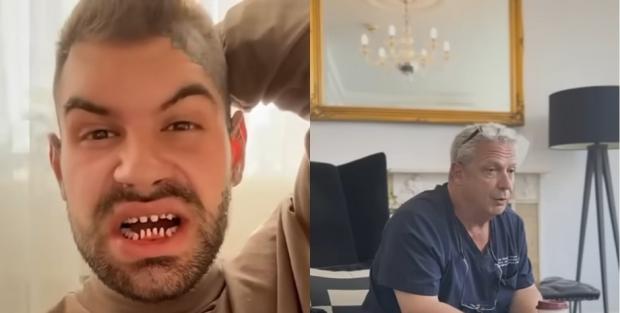 Великий ризик втратити власні зуби набагато раніше: Про що мовчать турецькі стоматологи, які “дешево” встановлюють вініри (відео)