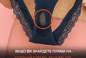 Якщо ви знайшли пляму від «відбілювача» на спідній білизні, ось що це означає