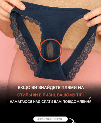 Якщо ви знайшли пляму від «відбілювача» на спідній білизні, ось що це означає
