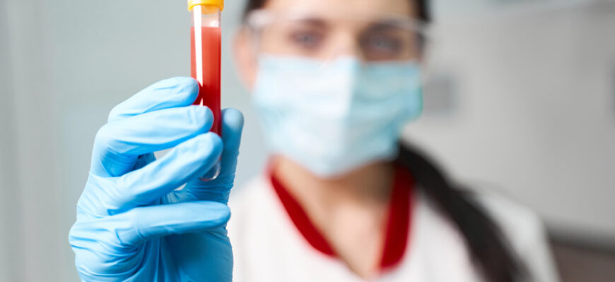 Який у вас характер за групою крові: популярна теорія з Японії, що збігається у 99%