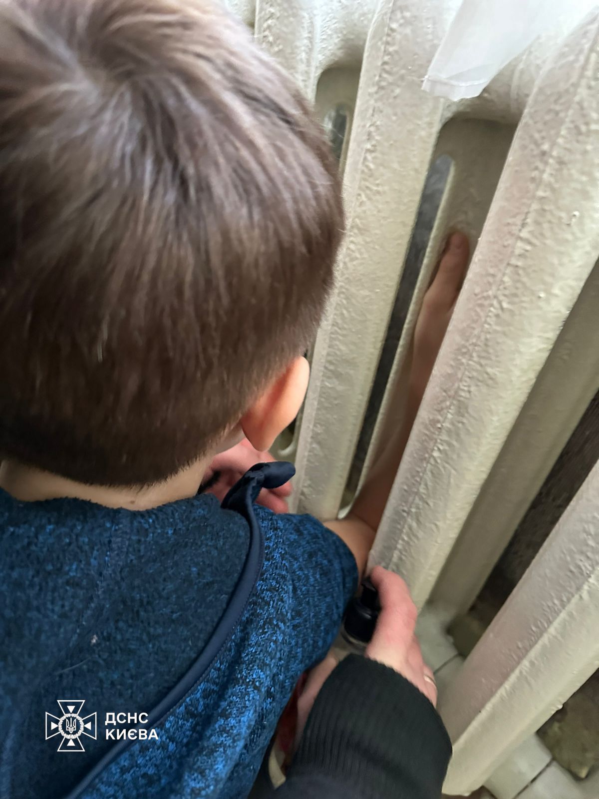 Рука хлопчика 2016 року народження застрягла між секціями батареї опалення в районі ліктьового суглоба
