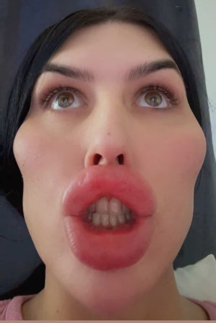 Софія витратила понад 500 тисяч фунтів стерлінгів на пластичні операції