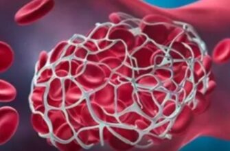 Бережіться! Популярні продукти, які можуть спричинити утворення тромбів