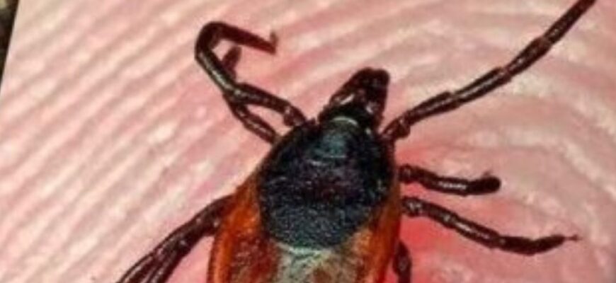 Лісники розкрили простий спосіб захисту від кліщів: достатньо одного предмета (фото)