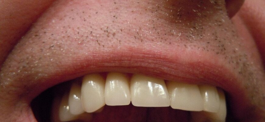 Топ продуктів, які руйнують зуби — і це не солодощі