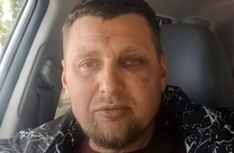 У Луцьку ветеран з інвалідністю заявив про побиття військовими ТЦК, ті звинуватили його в провокуванні (фото, відео)