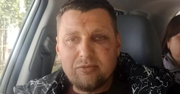 У Луцьку ветеран з інвалідністю заявив про побиття військовими ТЦК, ті звинуватили його в провокуванні (фото, відео)