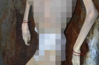 Трагедія на Вінниччині: 10-річний хлопчик з інвалідністю помер від голоду через байдужість дорослих