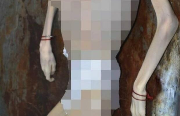 Трагедія на Вінниччині: 10-річний хлопчик з інвалідністю помер від голоду через байдужість дорослих
