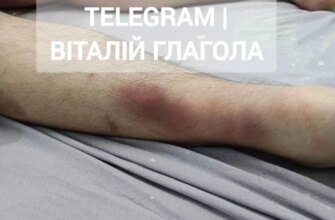 Смерть у ТЦК: що насправді сталося з мобілізованим киянином під час утримання