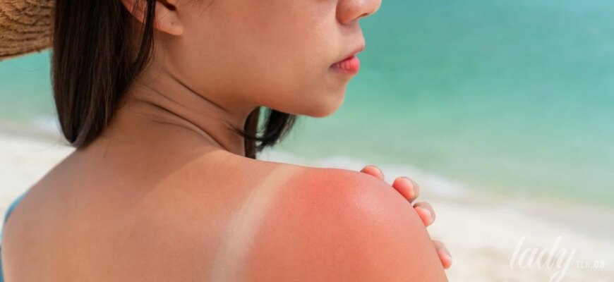 Сонячний удар по шкірі: чому ваш SPF не працює і коли його наносити насправді