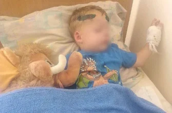 Водій ТЦК збив дитину на Одещині — батьки розповіли про стан хлопчика