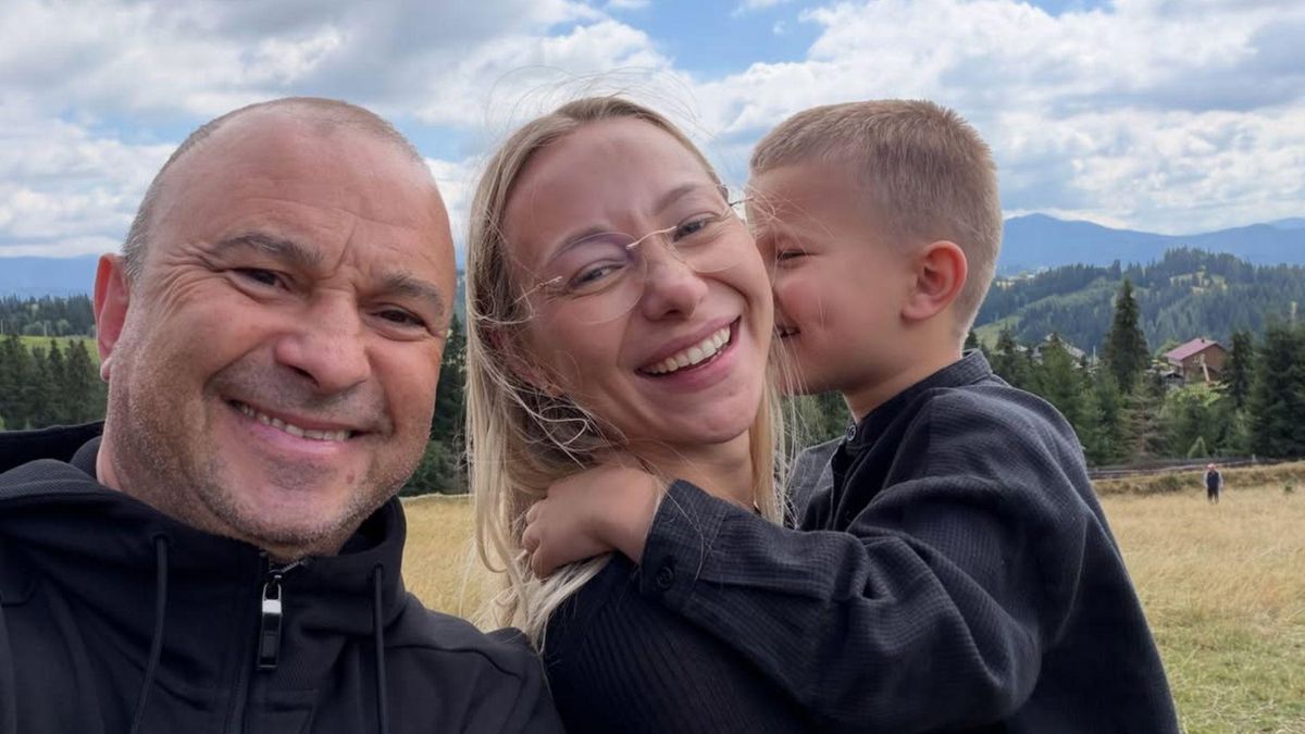 Мріяла про ідеал, але зіткнулася з невдалою пластикою: 32-річна дружина Віктора Павліка відверто розповіла про втручання в зовнішність