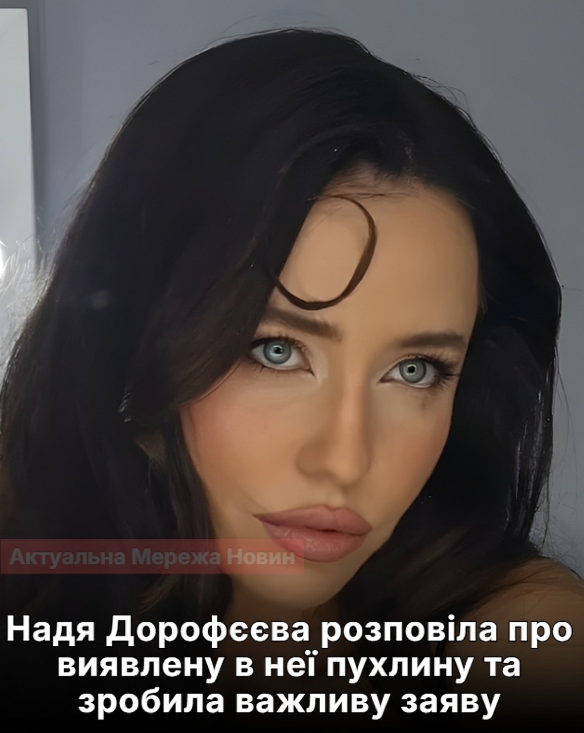 Надя Дорофєєва відверто розповіла про перенесену операцію: видалили пухлину